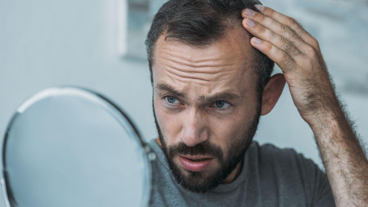 La caída del cabello es algo totalmente natural y se puede deber a muchos factores.