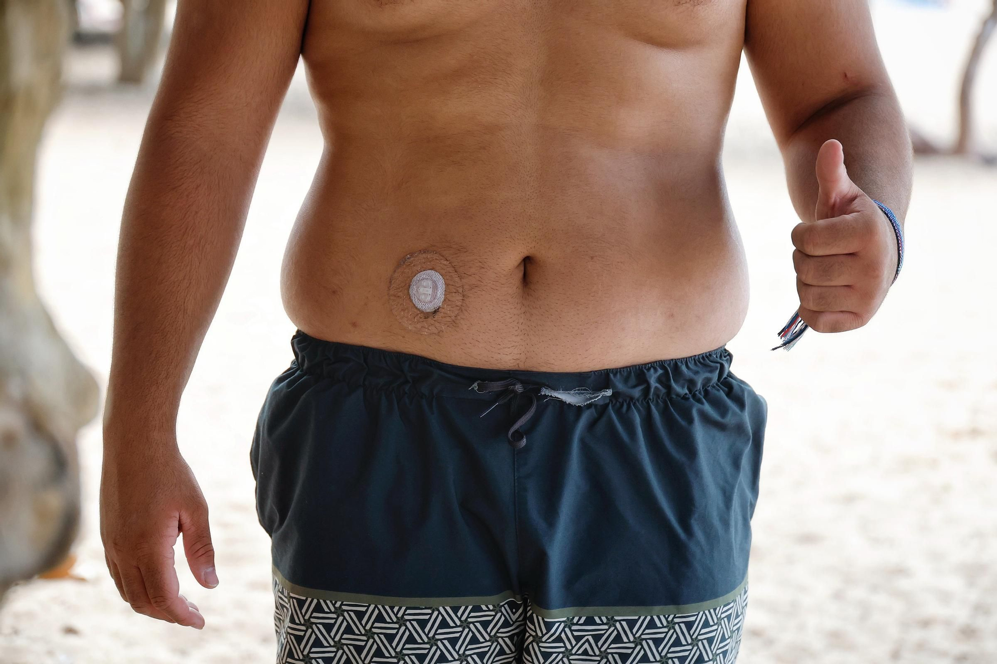 Adolescentes con diabetes disfrutan del verano en la Playa de Las Teresitas