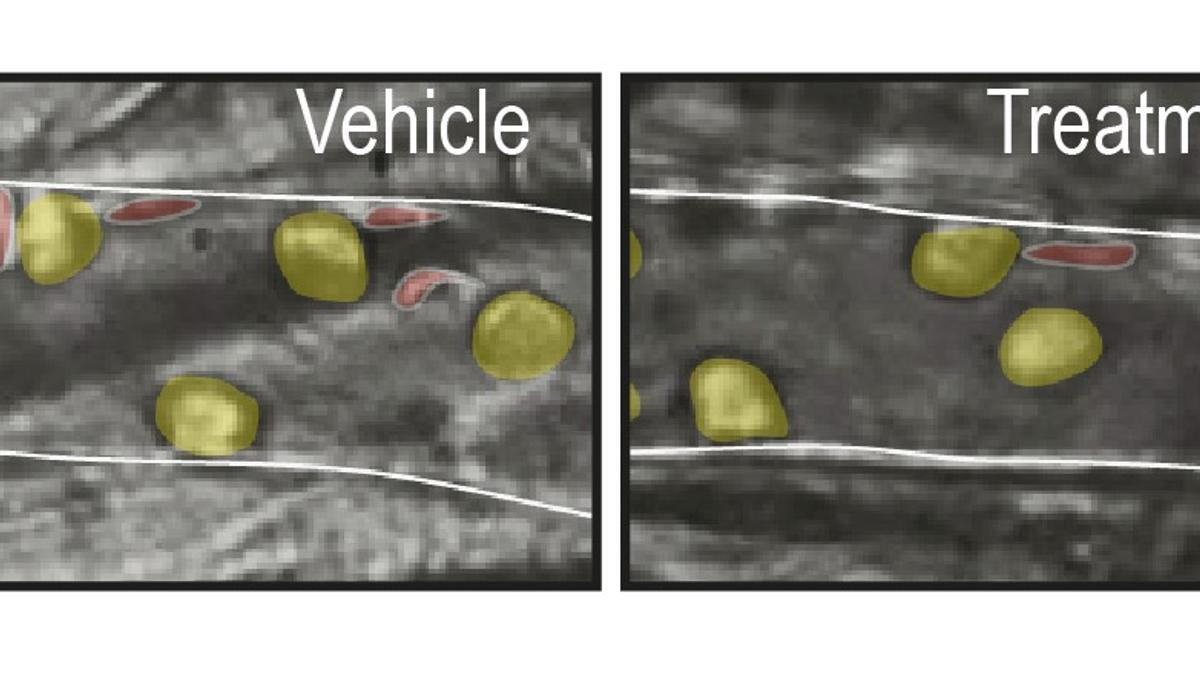 Científicos del CNIC descubren por qué los infartos son menos dañinos por la noche