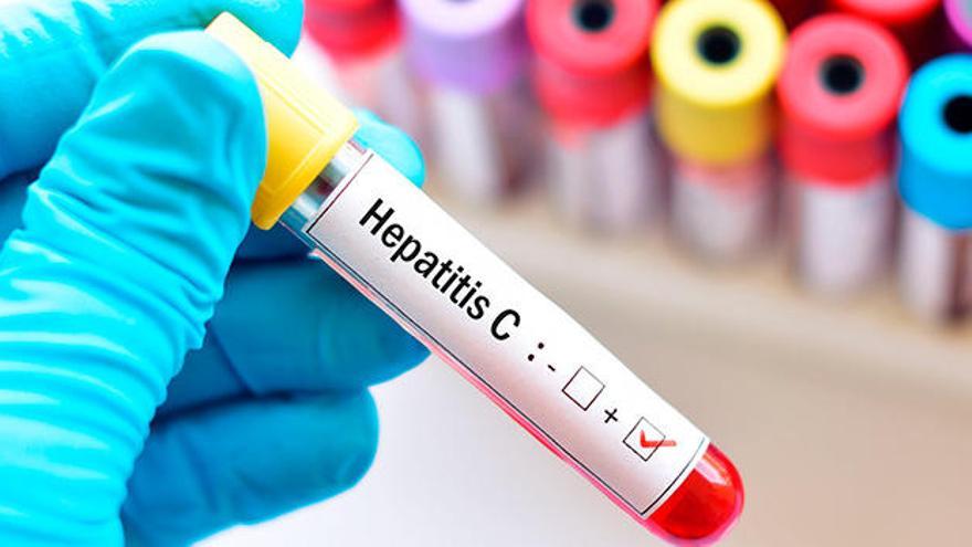 La Hepatitis C, una enfermedad silenciosa pero curable en su totalidad