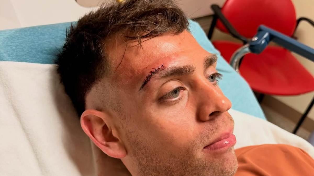 El corte que se hizo Gonza antes de clasificarse para octavos de final