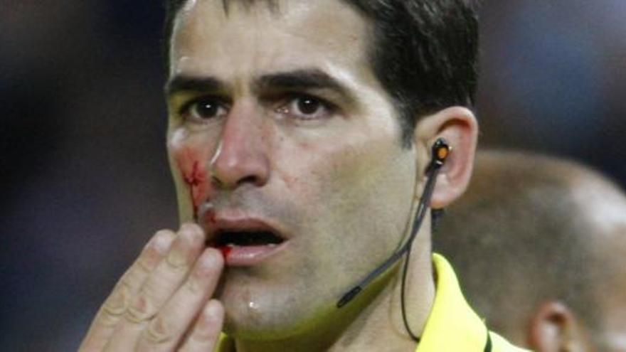 Uno de los asistentes del Granada-Mallorca fue agredido por un aficionado.