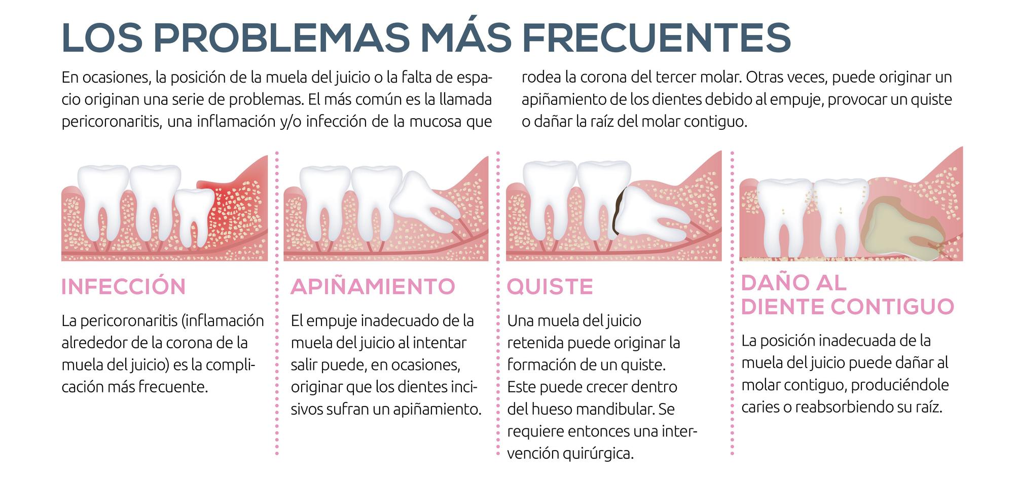 Problemas más frecuentes