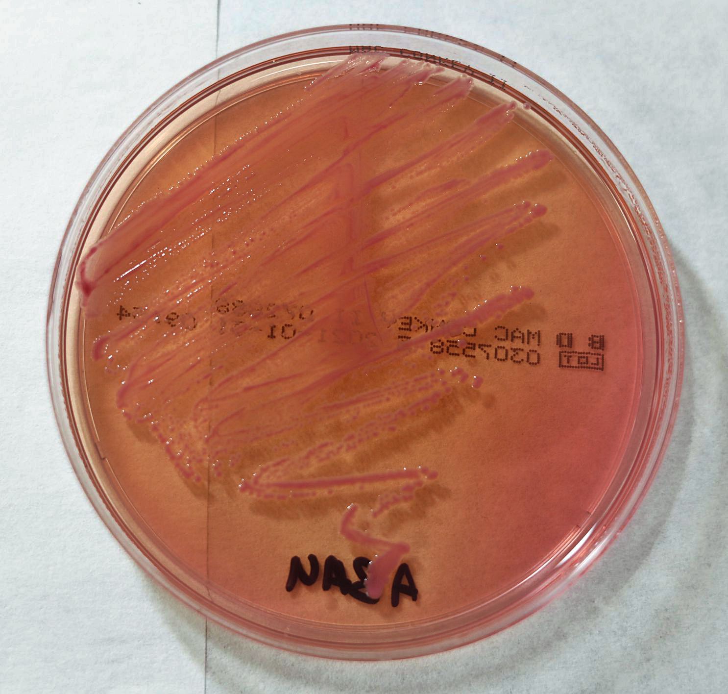 Acinetobacter baumanii, en una placa de cultivo en Can Misses. 