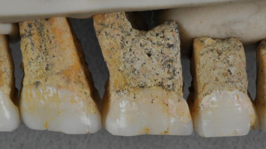 Dentadura de l&#039;Homo Luzonensis