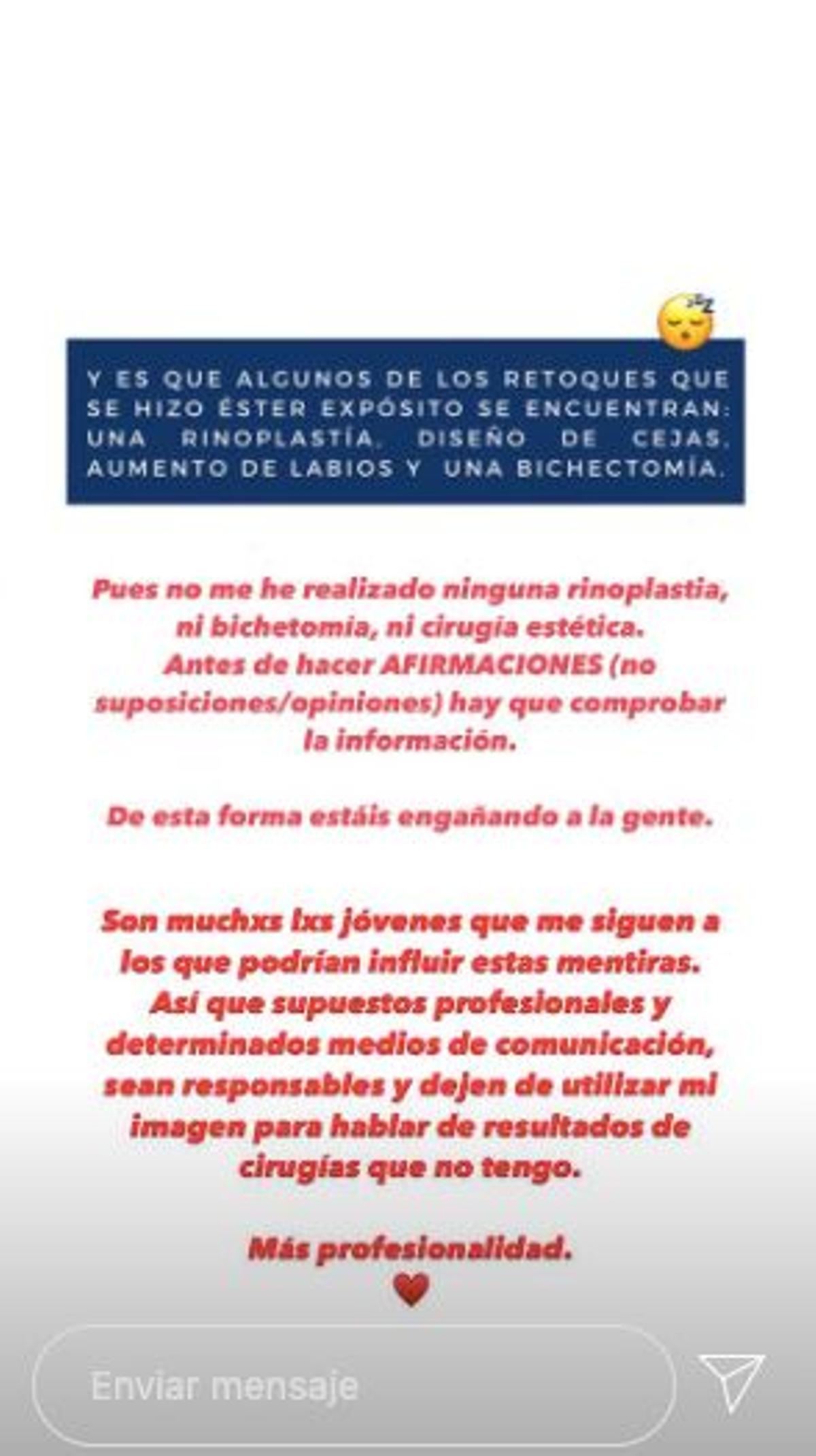 Ester Expósito responde a los que dicen que se ha operado