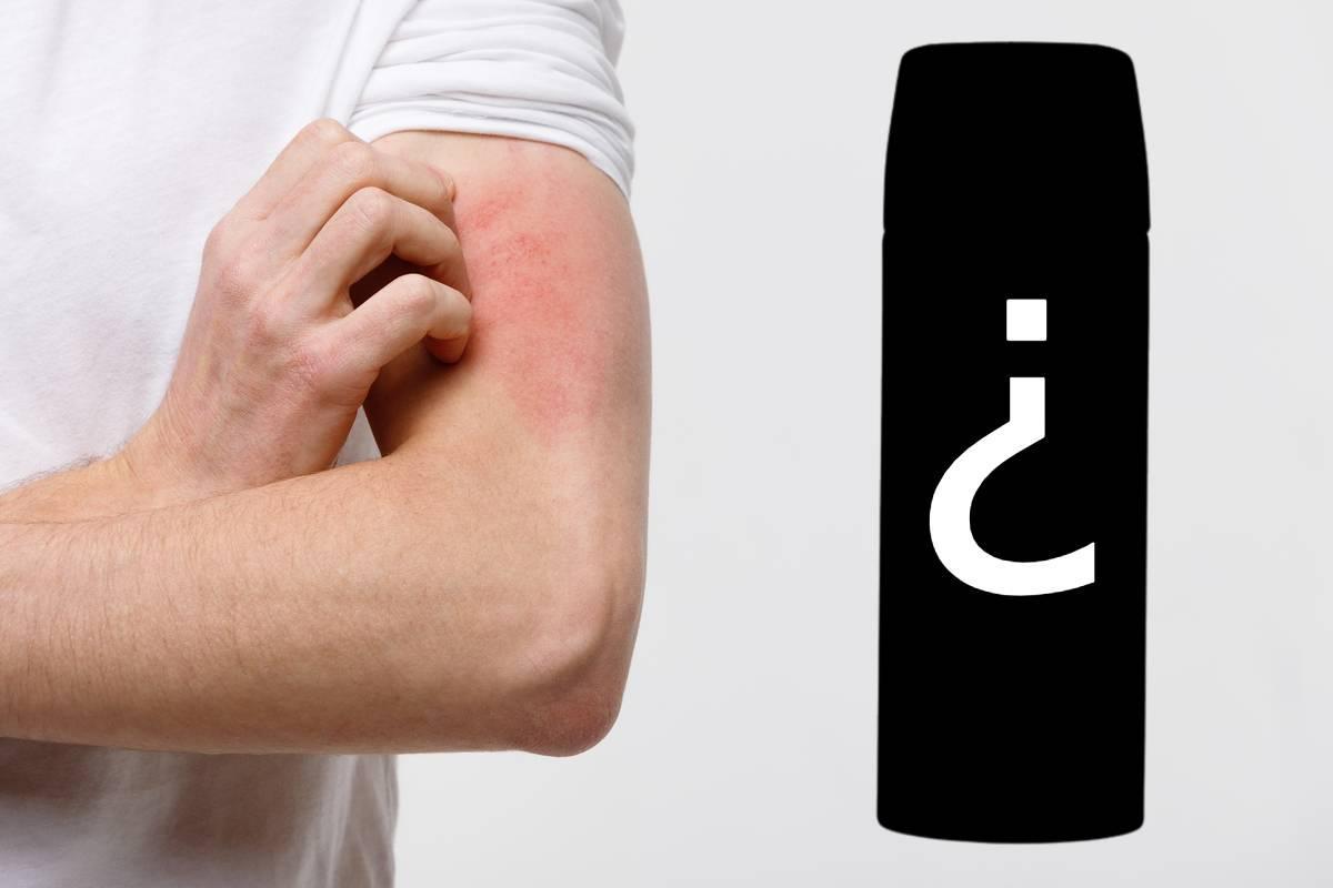 El truco que nadie se esperaba para evitar las picaduras de mosquito