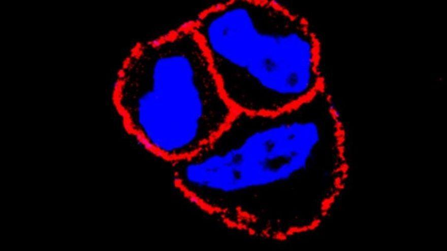 El CSIC evidencia que el uso combinado de un nuevo fármaco mejora la eficiencia de algunas terapias de cáncer de mama.