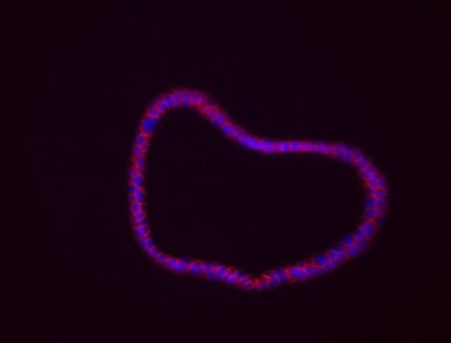 Organoide de colon generado a partir de tumores de ratón (CSIC)