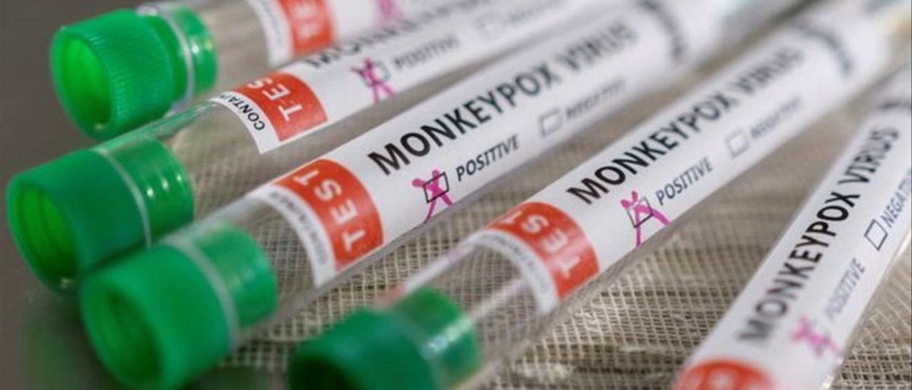 Los casos de viruela del mono siguen aumentando en la Región de Murcia, hasta alcanzar los 31 en la actualidad. | AGENCIAS
