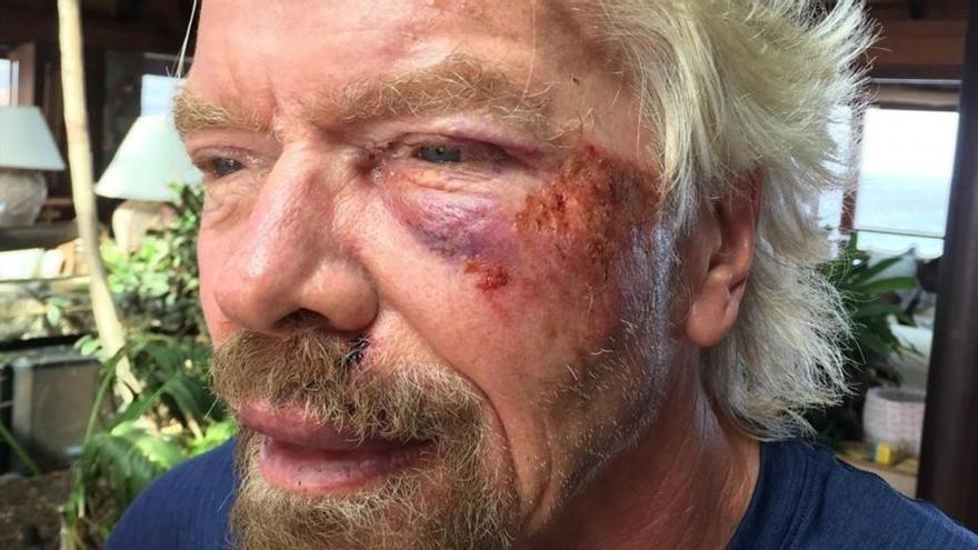 Richard Branson sufre un accidente de moto