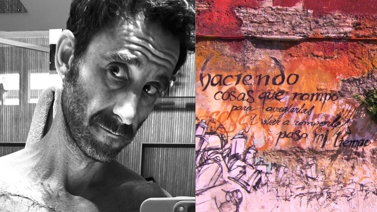 Dani Rovira comparte sus cicatrices físicas y emocionales en redes sociales