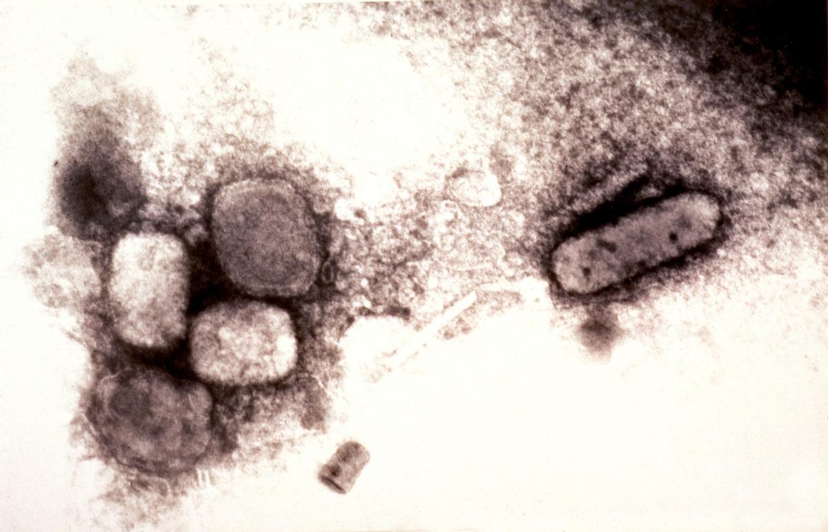 Historia (1): ¿Cómo se terminan las pandemias? Del cangrejo de patas blancas a la viruela