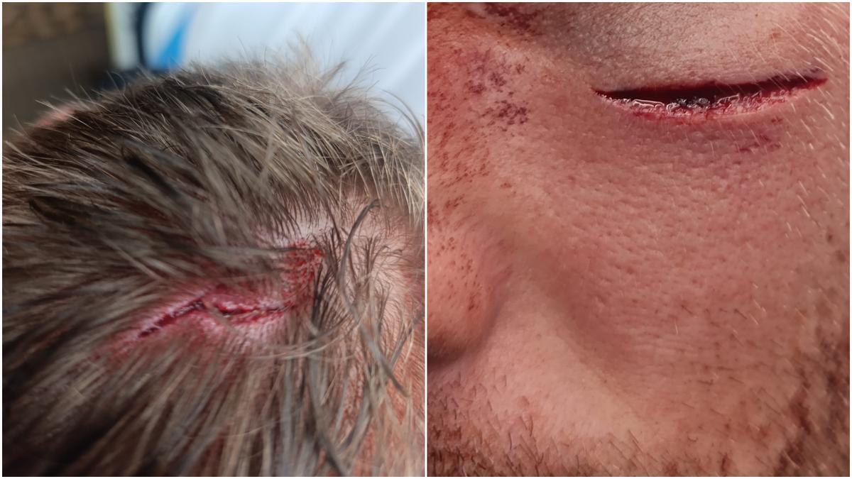 Heridas sufridas por la víctima