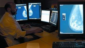 Un especialista revisa mamografies digitals a l’Hospital del Mar de Barcelona.