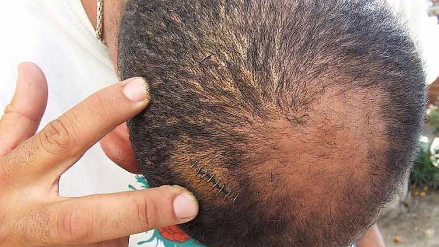 El marroquí sufrió varias heridas sangrantes en su cabeza