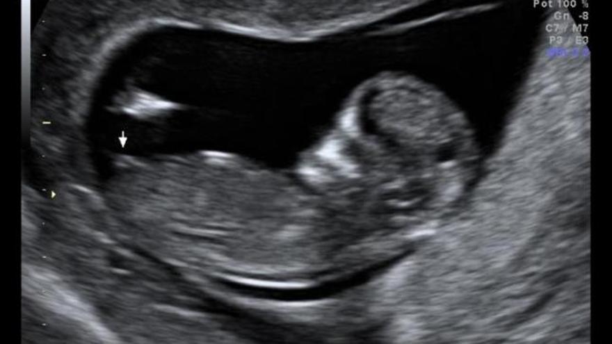 El Hospital 9 de Octubre determina el sexo del bebé en el primer trimestre