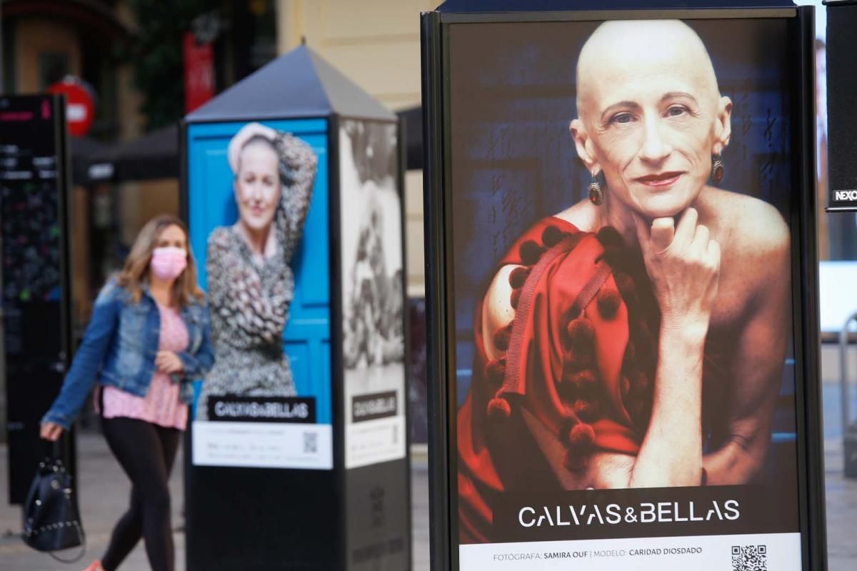 'Calvas y bellas', una invitación a mirar al cáncer a los ojos