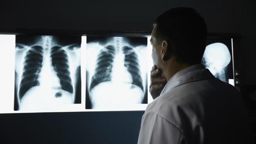 Sanidad Alicante: Una de las técnicas radiológicas «insustituibles» es el  TAC, clave para el diagnóstico y seguimiento de los tumores, especialmente  del cáncer de pulmón. A éste se suman la colonoscopia virtual,