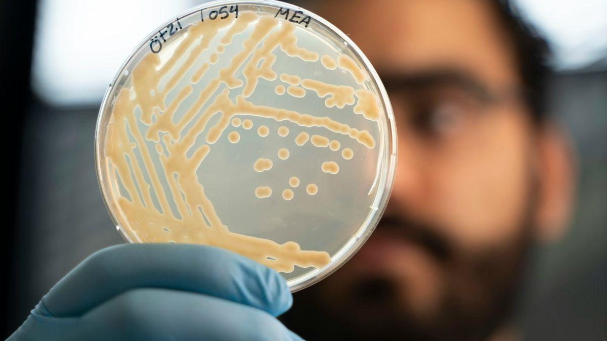Colonias de levadura tomadas de una muestra del estómago de Ötzi.