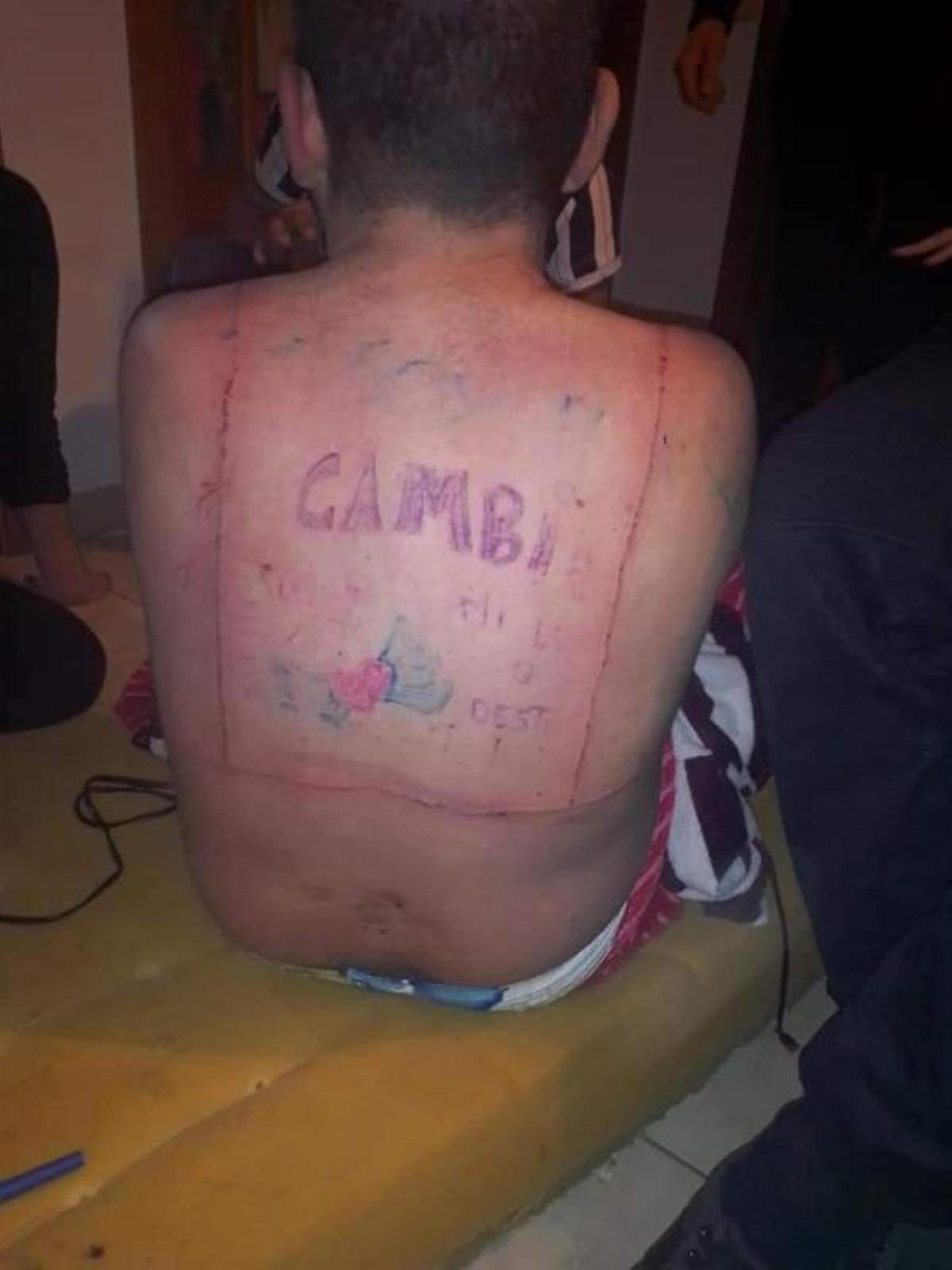 El denunciante, con tatuajes hechos por los acusados.