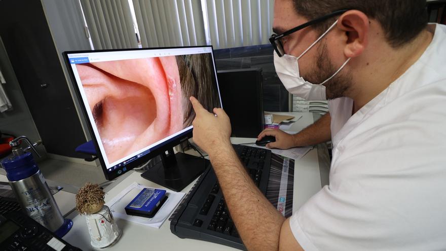 Sanidad potencia la teledermatología para detectar en 24 horas cáncer de piel