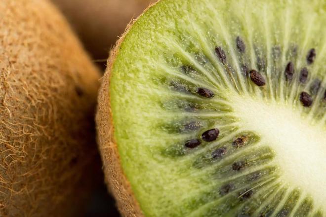 Beneficis del kiwi. / FREEPIK