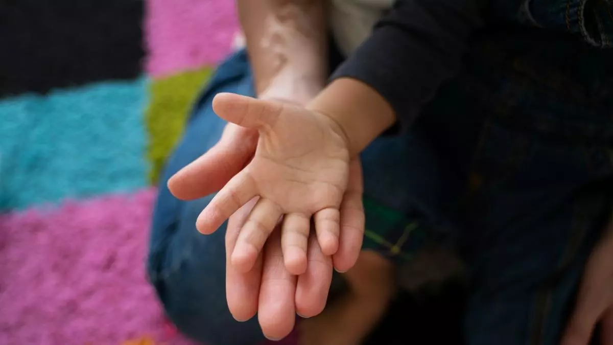 La enfermedad rara que afecta a miles de personas en España sin saberlo: el 96% de los casos está sin diagnosticar