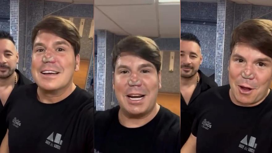 La impactante reaparición de Lucas (Andy y Lucas) tras su última operación de nariz: &quot;Necrosis&quot;