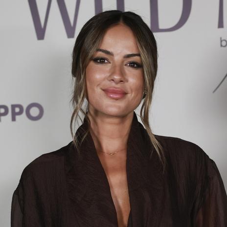 Sufro acné como Melyssa Pinto y estos son los cosméticos que me ayudan a tratarlo