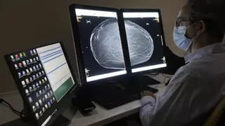 La mitad de los nuevos casos de cáncer de mama en Córdoba se diagnostican en los programas de cribado
