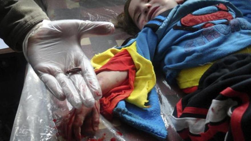 Un médico extrae una bala a una niña en Homs.