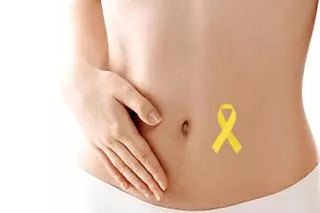 Endometriosis, la enfermedad del silencio: ¿qué es y a quién afecta?
