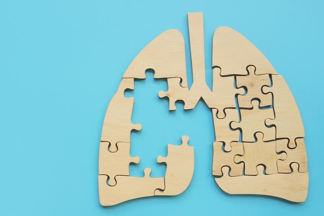 Descubren una nueva causa del asma que podría llevar a su cura.