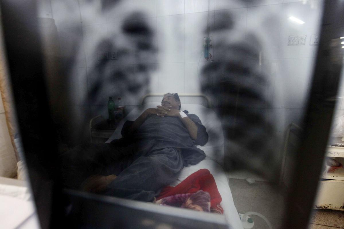 PSH04 PESHAWAR (PAKISTÁN), 24/03/2017.- Un paciente enfermo de tuberculosis recibe tratamiento médico en un hospital de Peshawar, Pakistán, hoy, 24 de marzo de 2017. La Organización Mundial de la Salud (OMS) emitió ayer un código ético que debe guiar la atención que se presta a las personas con tuberculosis, reducir el estigma y discriminación que sufren y poner de lado prácticas como el aislamiento involuntario del enfermo, salvo en casos excepcionales. EFE/ARSHAD ARBAB