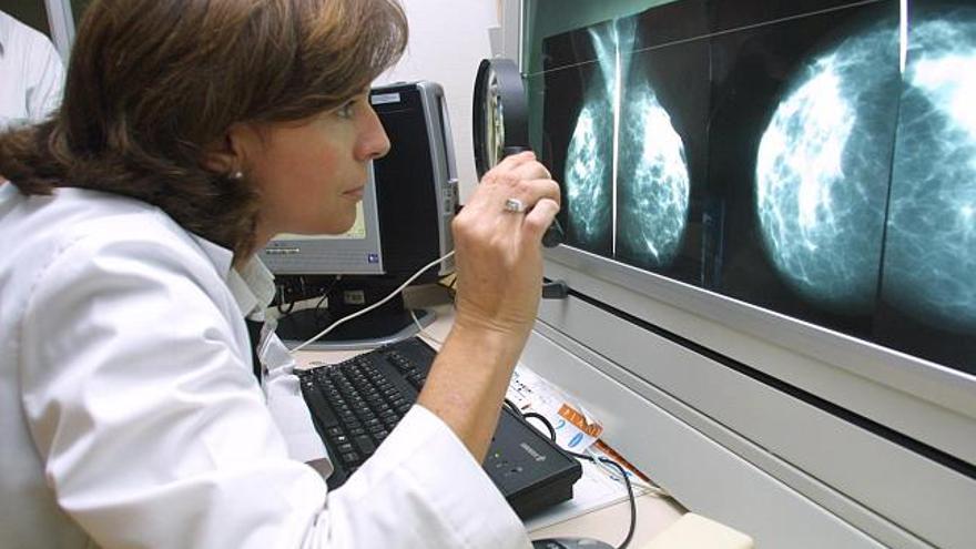 Una especialista analiza la radiografía de unos pechos para verificar o descartar la existencia de un tumor