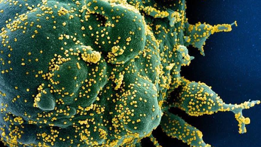 Microfotografía electrónica de barrido coloreada de una célula apoptótica (verde) muy infectada con partículas del virus del SARS-COV-2 (amarillo), aislada de una muestra de un paciente. Imagen capturada en la Instalación de Investigación Integrada del NIAID (IRF) en Fort Detrick, Maryland. NIAID, CC BY-SA