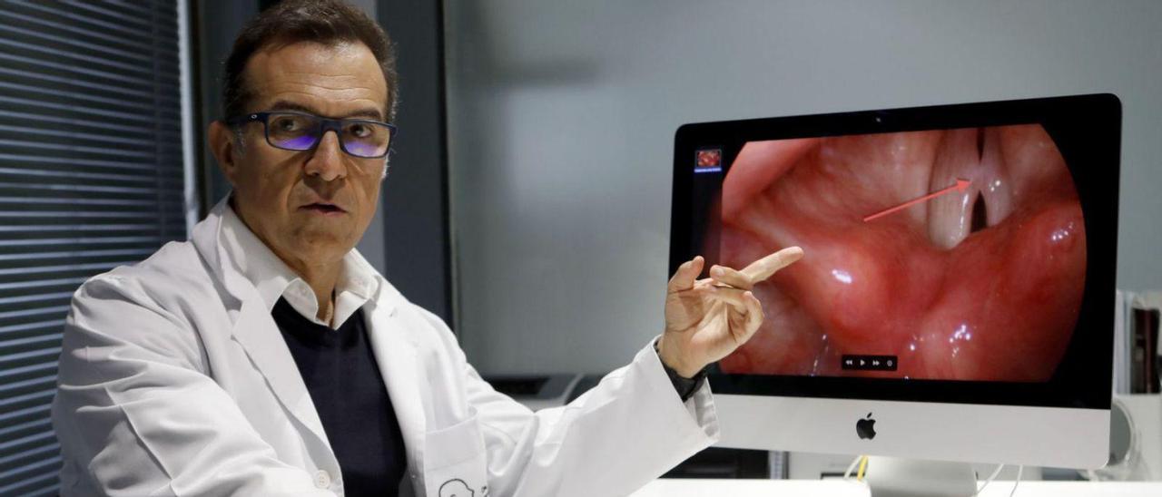 El otorrinolaringólogo Manuel Estévez, en su consulta de Vigo, muestra una imagen de las cuerdas vocales.