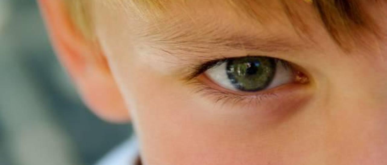 Un 5% de los niños tiene «ojo vago»