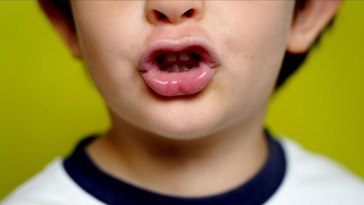 Un niño de cuatro años realiza ejercicios con la boca para aprender a pronunciar bien