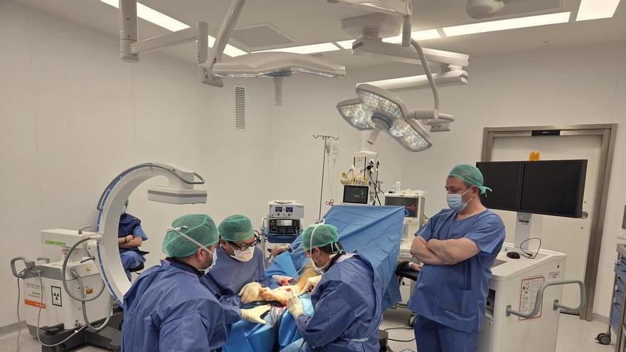 El Hospital Vithas Valencia Turia corrige con éxito una deformidad severa e incapacitante del pie poco frecuente en paciente adulto
