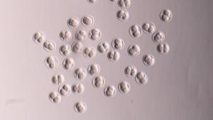 290 variants genètiques determinen l’arribada de la menopausa