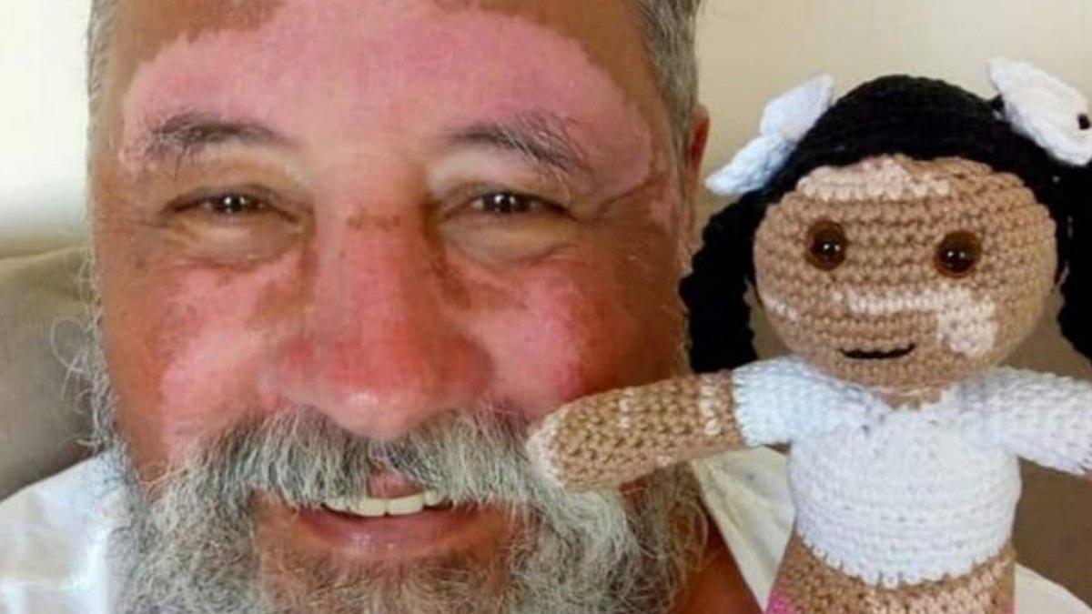 João Stanganelli Junior, el abuelo brasileño que teje muñecas con vitíligo.