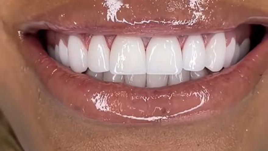 El Colegio Oficial de Dentistas alerta contra las pseudoterapias en Castellón: de productos milagro a retos virales