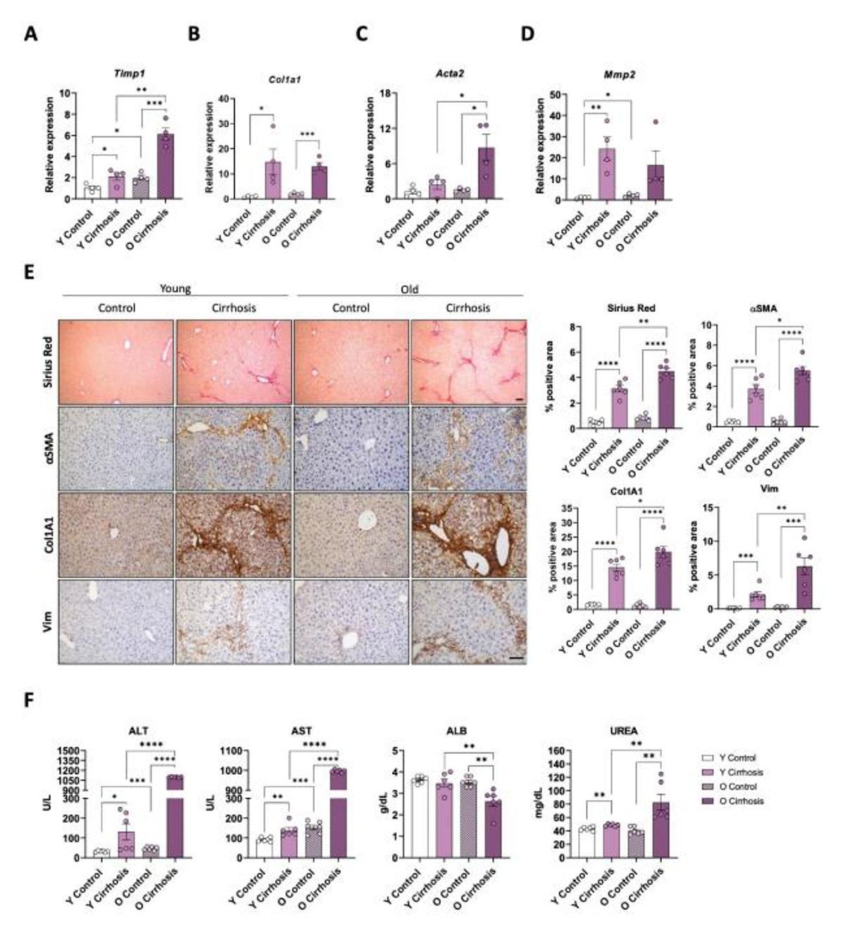 Una de las grácias del trabajo de la UMH de Elche donde se aprecia la diferencia entre áreas sanas y con cirrosis