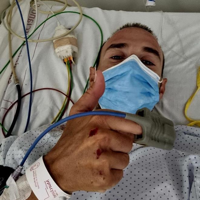 Detenido el conductor que atropelló a Alejandro Valverde y se dio a la fuga en Murcia