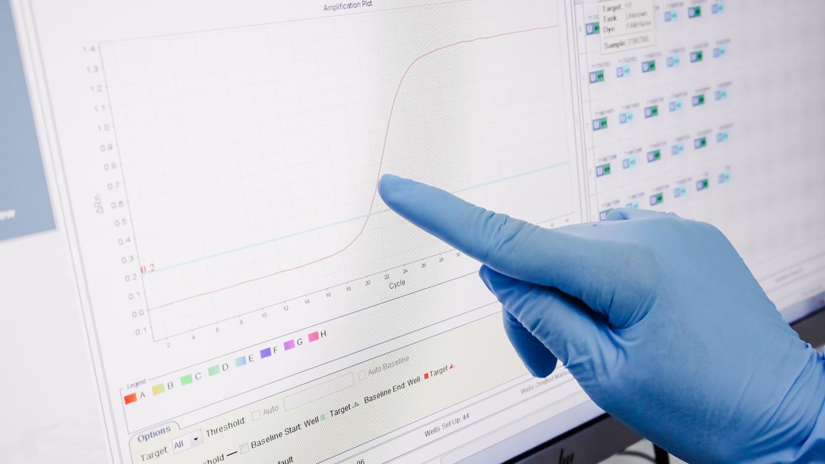 Pantalla de un ordenador con resultados positivos de viruela del mono, en el Hospital Ramón y Cajal.