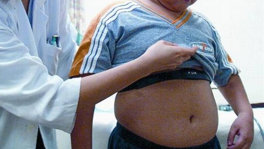 La obesidad prevalece en adolescentes del Mediterráneo, según un experto