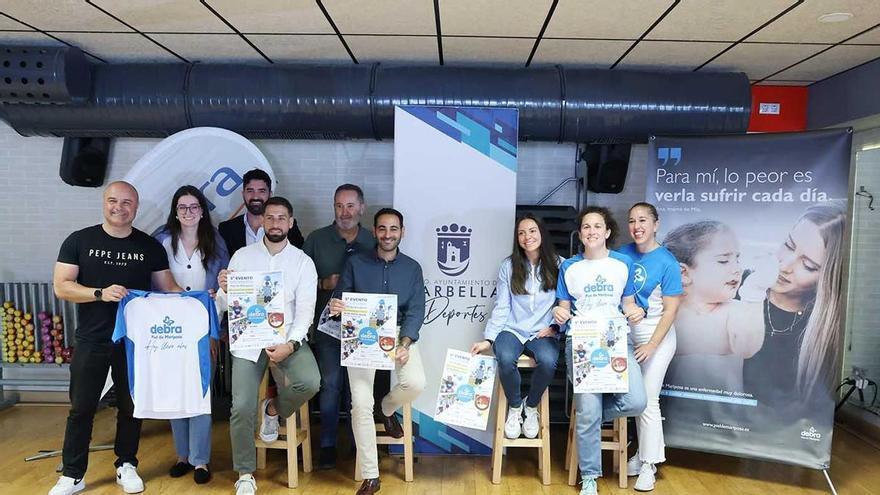 Marbella organiza un evento solidario a favor de Debra Piel de Mariposa