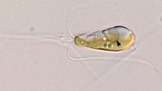 Descubren una nueva forma de vida nacida de la fusión de una bacteria y un alga
